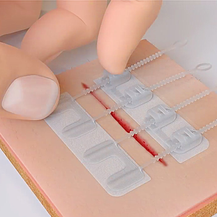 wound care dressings
