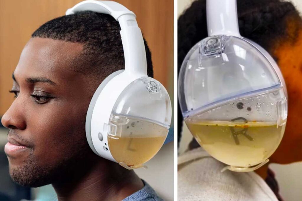 Otoset This device cleans a year's worth of earwax buildup in minutes